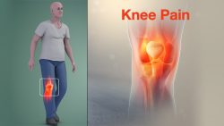 Does MagniLife Knee Pain Relief Really Work?