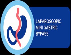 Transform Your Life with Mini Gastric Bypass in Punjab