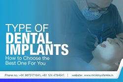 Dental Implants care in Gurgaon