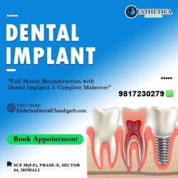 Affordable Dental Implant Solutions at Esthetica Dental Chandigarh, Mohali