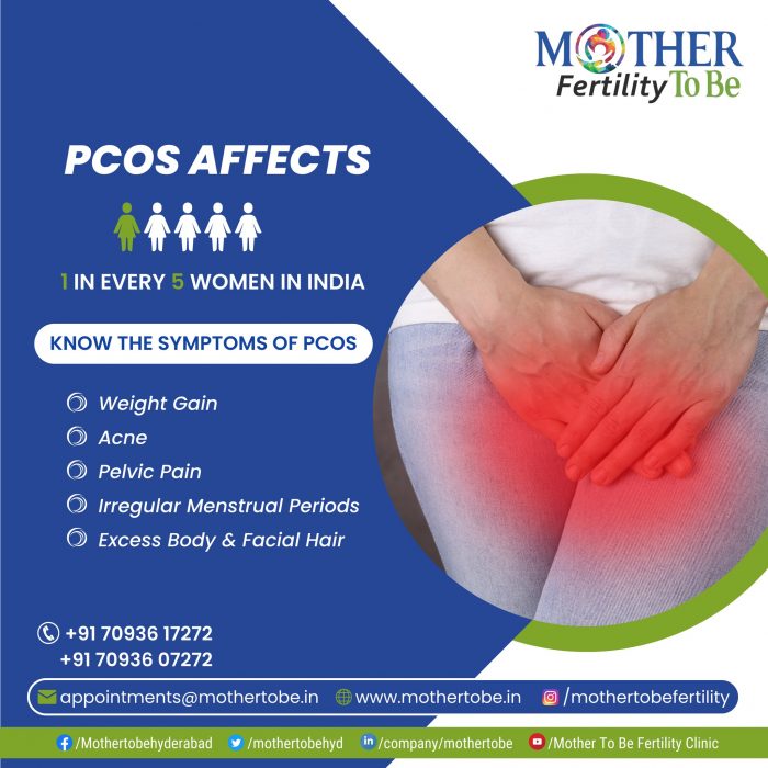 Best PCOS Treatment in Hyderabad | Best PCOS Specialist in Hyderabad