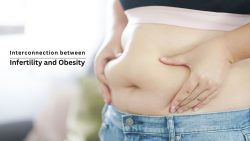 Interconnection between Obesity and Female Infertility