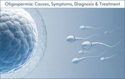 Oligospermia (Low Sperm Count): Causes, Symptoms, & Treatment
