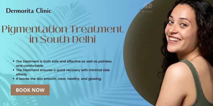 Pigmentation Treatment in South Delhi