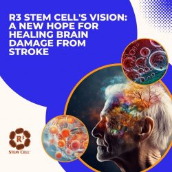R3 Stem Cell’s Vision: A New Hope for Healing Brain Damage from Stroke