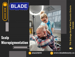 Scalp Micropigmentation at Blade Beauty Boutique in Toronto