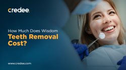 How Much Does Wisdom Teeth Removal Cost? ( In 2024 )