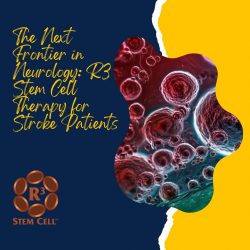 The Next Frontier in Neurology: R3 Stem Cell Therapy for Stroke Patients