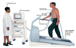 Understanding Heart Health Tests: Treadmill Test and Angiography Costs in Delhi