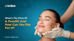 What’s The Price Of A Facelift And How Can You Pay For It?