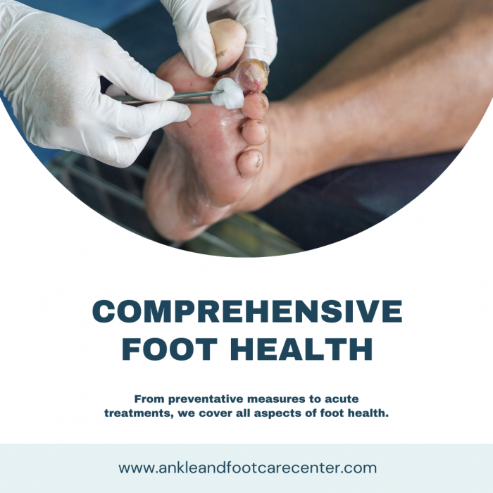 Bunion Surgery Whittier