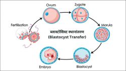 Blastocyst Meaning in Hindi | ब्लास्टोसिस्ट क्या है? | ब्लास्टोसिस्ट स्थानांतरण