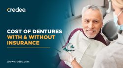 How Much Do Dentures Cost With Or Without Insurance?