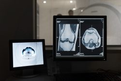 Meticulous Research® Releases Comprehensive Report on Digital X-ray Systems Market