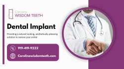 Customized Tooth Implants Plans