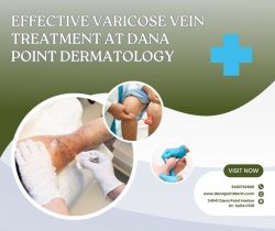 Effective Varicose Vein Treatment at Dana Point Dermatology