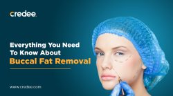 How Much Does Buccal Fat Removal Cost?