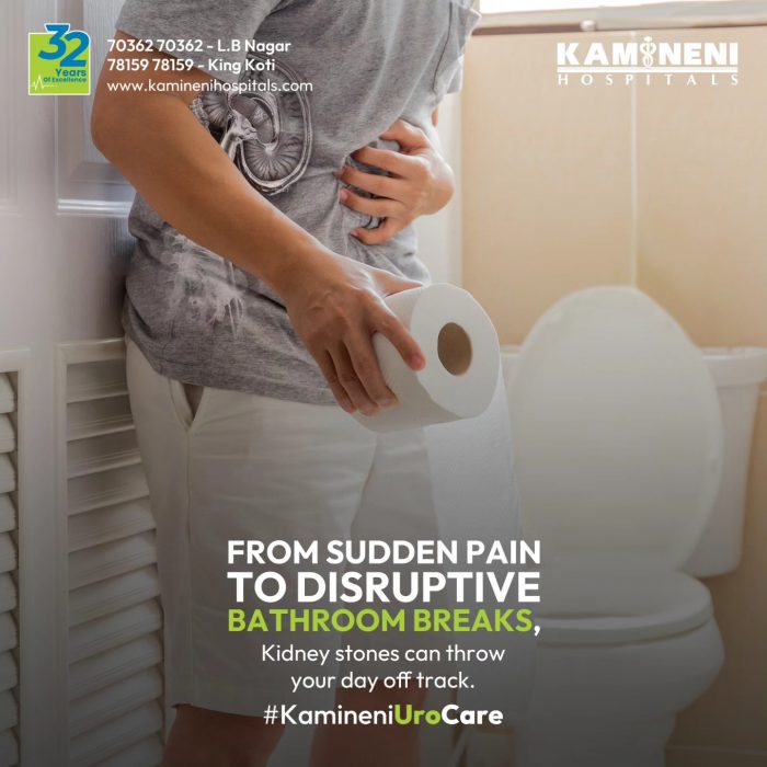 “Expert Kidney Stone Care at Kamineni Hospitals: Restore Your Comfort and Routine”