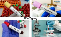 HLA Typing Market Expected to Reach $1.9 Billion by 2029