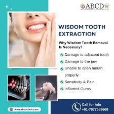 Expert Tooth Extraction Services in Bapuji Nagar at Abcd Clinic