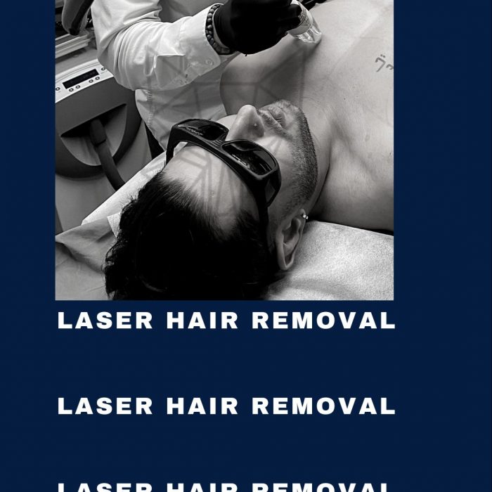 Men Hair Removal Sydney: Effective Treatments