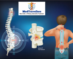 New Treatment for Spinal Cord Injury – MedTravellers
