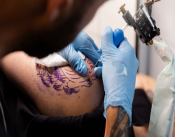 The Complete Guide to Tattoo Removal: Cost, Process, and Results