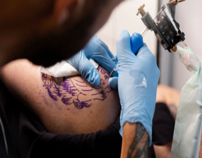 The Complete Guide to Tattoo Removal: Cost, Process, and Results