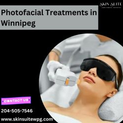 Photofacial Treatments in Winnipeg