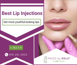 Revitalize Your Look with Lip Injections