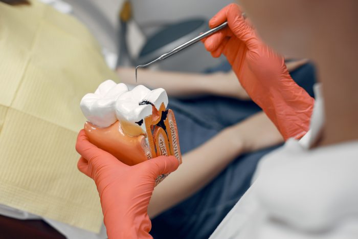 Root canal treatment in Coimbatore
