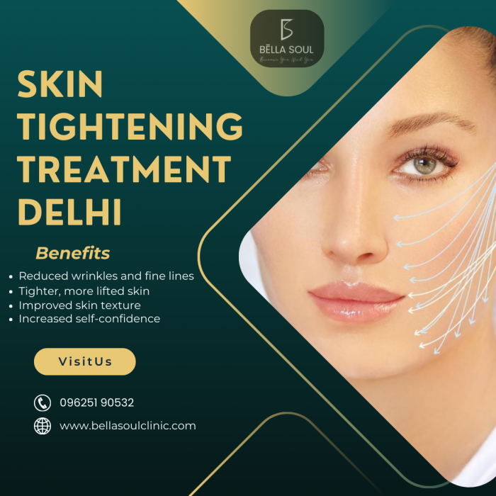 Skin Tightening Treatment Delhi