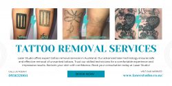 Safe and Effective Tattoo Removal in Auckland at Laser Studio