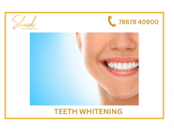 Teeth Cleaning in India – Tooth Scaling And Polishing for Sparkling Teeth