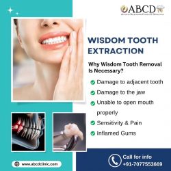 Tooth Extraction Services in Bapuji Nagar at Abcd Clinic