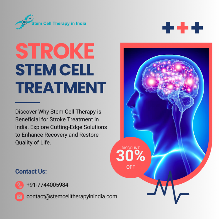 Why Stem Cell Therapy Is Beneficial Stroke Treatment in India