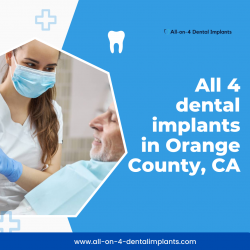 All 4 dental implants in Orange County, CA