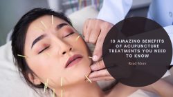 10 Amazing Benefits of Acupuncture Treatments You Need to Know