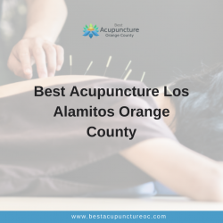 Best Acupuncture Los Alamitos Orange County