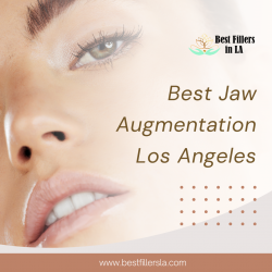 Best Jaw Augmentation Los Angeles