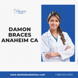 Damon Braces Anaheim CA