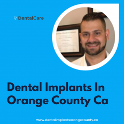 Dental Implants In Orange County Ca