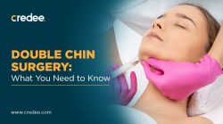 How Much Does Double Chin Surgery Cost? – Credee