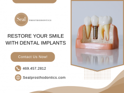 Get Expert Cosmetic Dental Implants for a Perfect Smile!