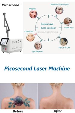 What does picosecond laser do?