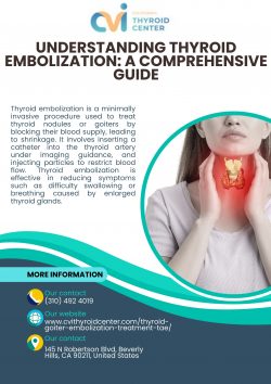 Understanding Thyroid Embolization: A Comprehensive Guide