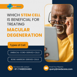 Which Stem Cell is Beneficial for Treating Macular Degeneration?