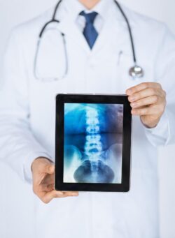 Purpose and Goals of Spine Surgery #spinesurgery #backpain #shortvideo
