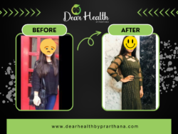 Top Dietician in Delhi