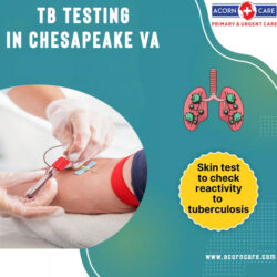 Get Accurate TB Testing Near Me in Chesapeake VA at Acorn Care